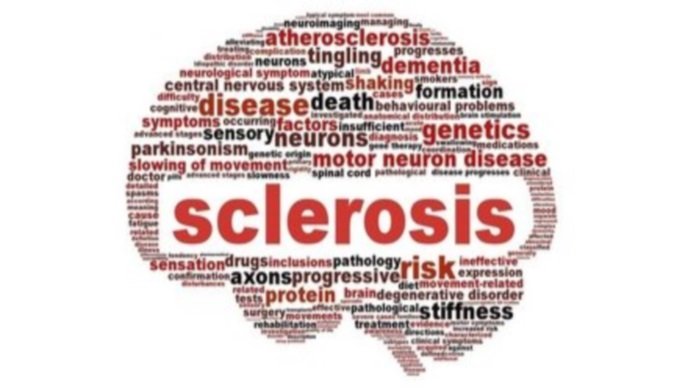 sclerosis